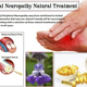 Illustration for article titled Natural Treatment for Peripheral Neuropathy